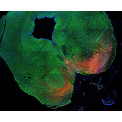 11PCW human midbrain